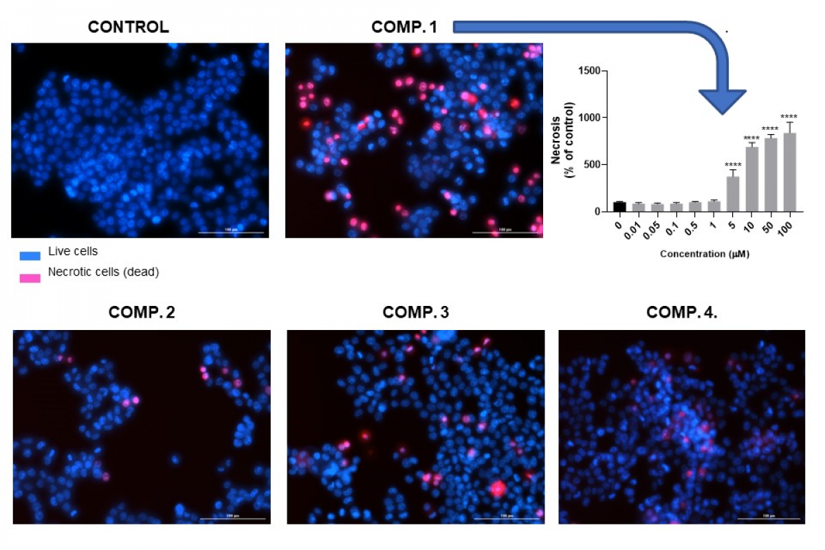 Caja Rural Central colabora con la UMH en el desarrollo de nuevos antitumorales para el tratamiento del cáncer de colon Caja Rural Central colabora con la UMH en el desarrollo de nuevos antitumorales para el tratamiento del cáncer de colon